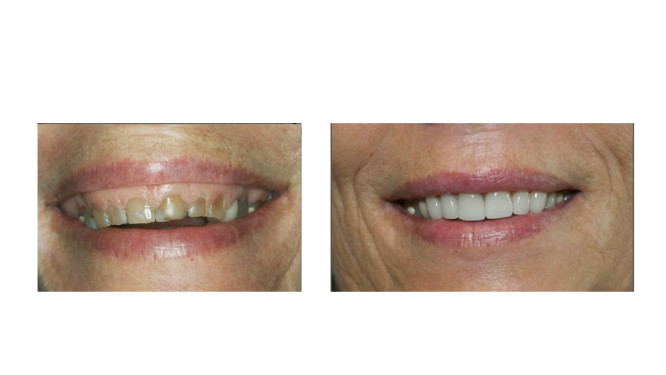 Restorative and reconstructive treatment diagram - Wynberg Dentistry